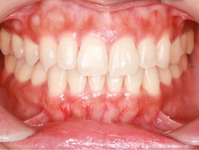 DEPOIS.jpeg - Depois